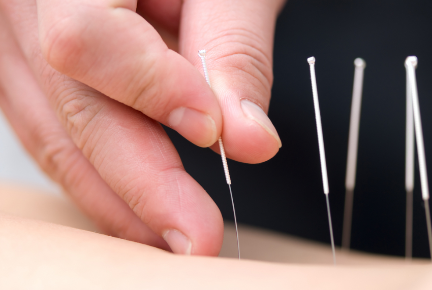 Picture of a hand holding an acupuncture needle